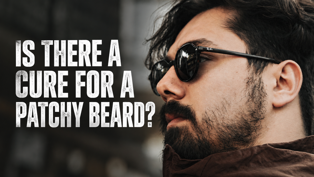 Is there a cure for a patchy beard?